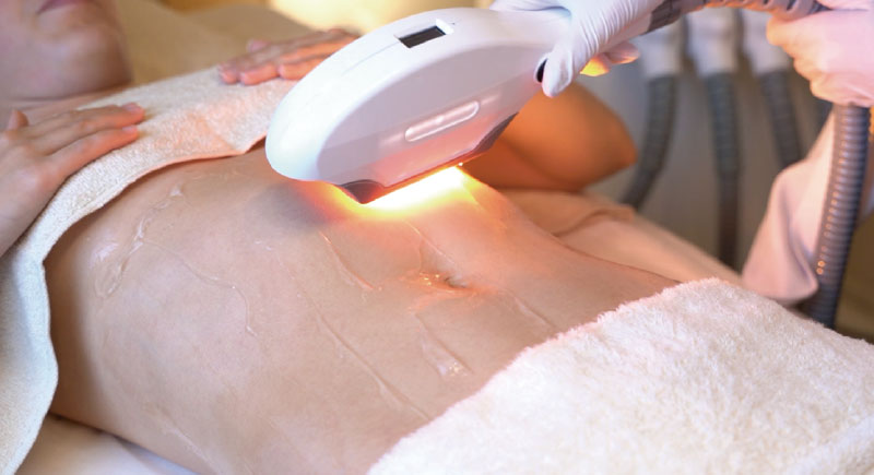 PegasusPro 光美容